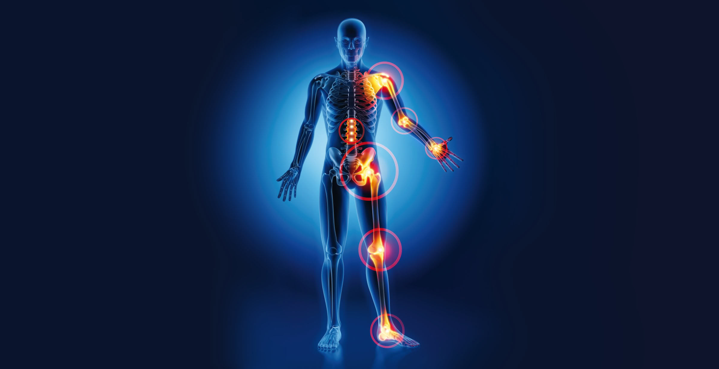 Silhouette eines menschlichen Körpers mit hervorgehobenen Gelenken in leuchtendem Orange auf blauem Hintergrund.